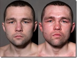 a_boxers_face_before_and_after_taking_a_few_punches_640_10