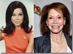 Mary-Tyler-Moore-Plastic-Surgery