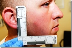 Ferguson-PO-Darren-Wilson-injuries-3-620x411