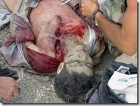 omar-khadr-wounded-300x225