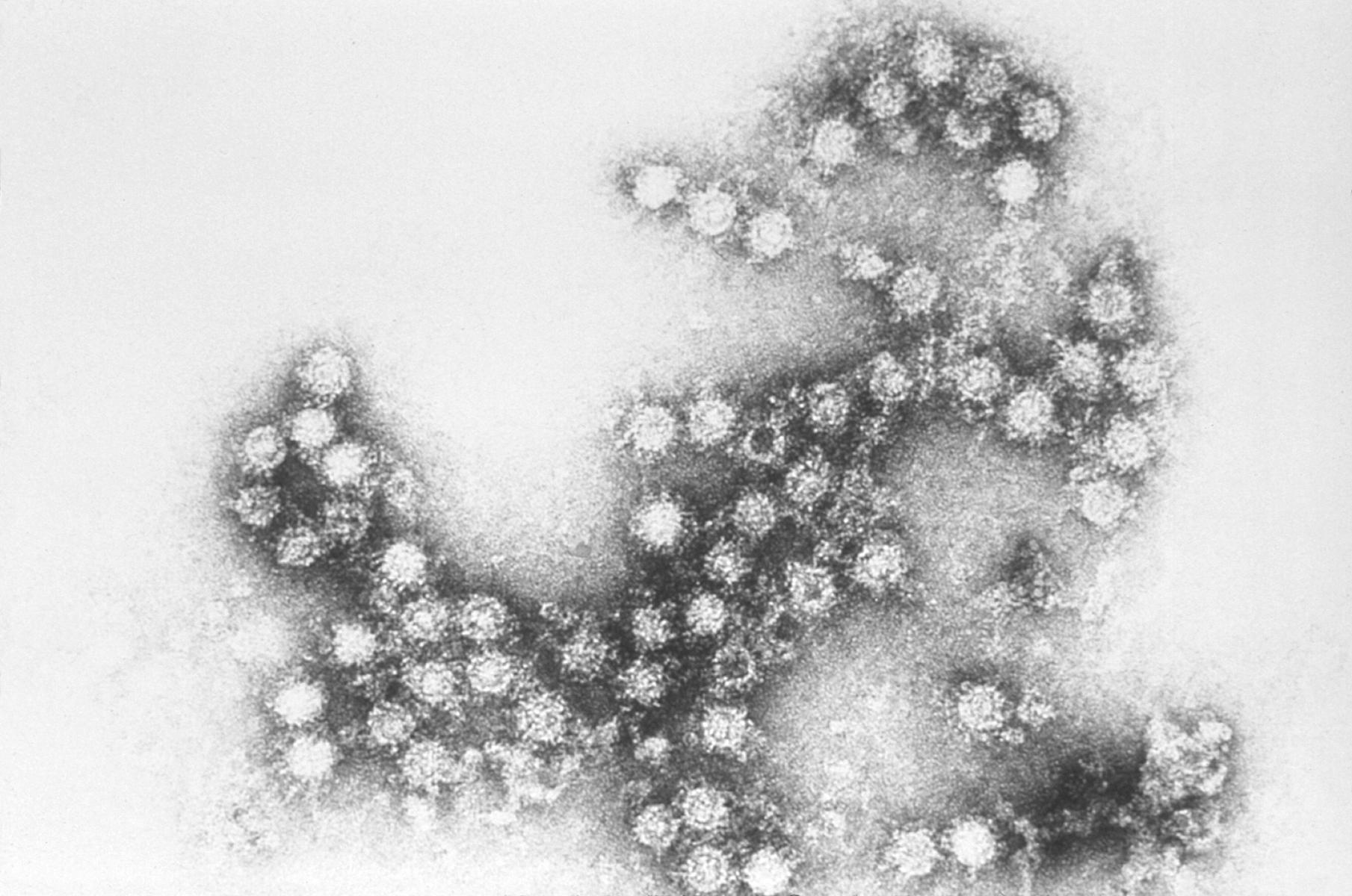 Coxsackie_B4_virus.JPG