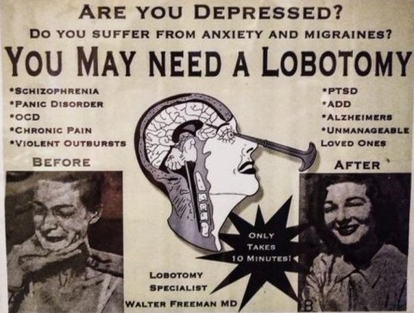 Lobotomy.jpg