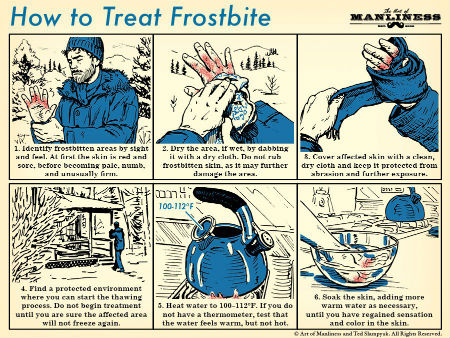 Treat-Frostbite-2.jpg