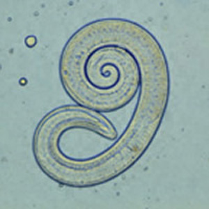 Trichinella_larv1_DPDx.JPG