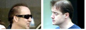 baldcelebs12.png