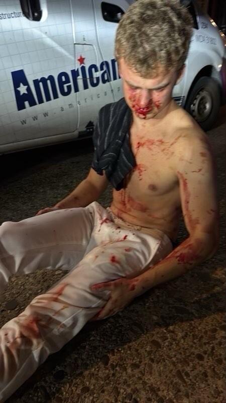 bigballsbloodied.jpg