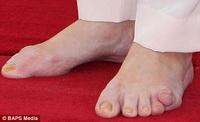 brown_toes.jpg