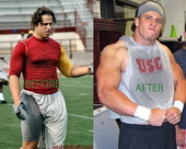 cushing_steroids.jpg