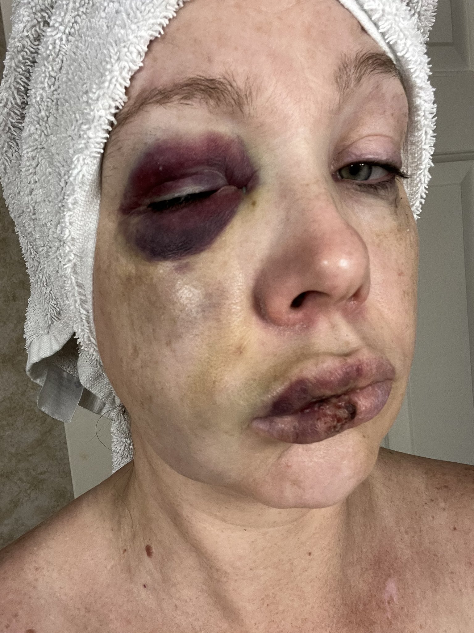 hollybeaten.jpg