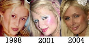 paris_hilton_three_nose_job.preview.jpg