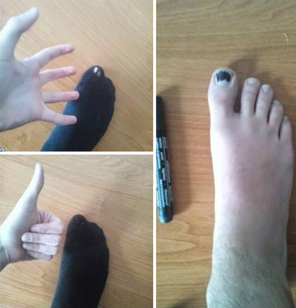 toe.jpg