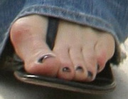 victoria_beckham_bunion2.jpg